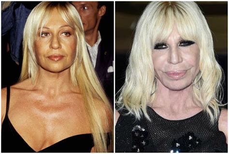 antonella versace prima e dop|donatella versace brand.